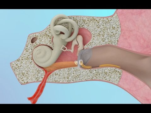 Clogged Ear Due to Ear Infection or Eustachian Tube Dysfunction