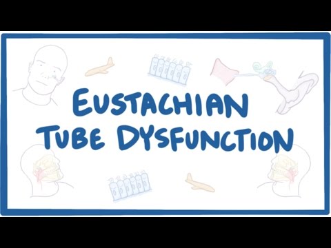 Eustachian tube dysfunction (ETD) - causes, symptoms, diagnosis, treatment, pathology