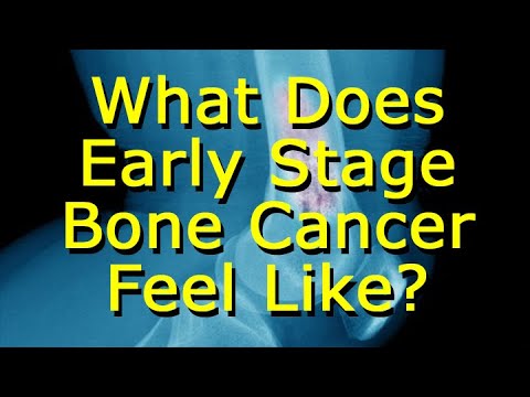 What Does Early Stage Bone Cancer Feel Like?