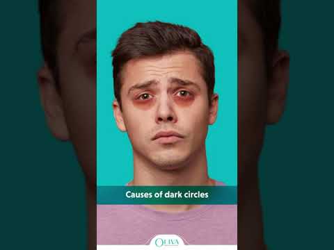 Dark Circles Under Eyes? 3 Reasons Which May Causes Dark Circles.