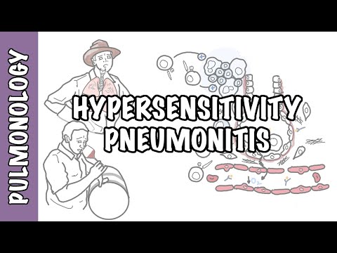 Hypersensitivity pneumonitis